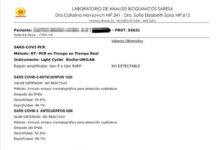 Otro falso positivo: Un peluquero se hizo un segundo test y dio negativo