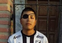 Denuncian causa armada por policías a joven que perdió un ojo
